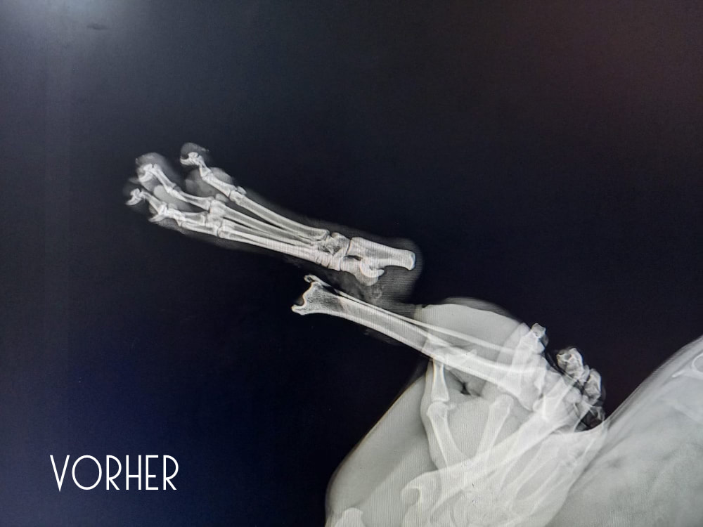 Röntgenbild der gebrochenen Knochen
